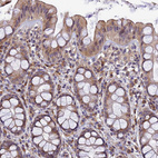 Immunohistochemical staining of human rectum shows moderate cytoplasmic positivity in glandular cells.