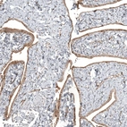 Immunohistochemical staining of human fallopian tube shows moderate membranous and cytoplasmic positivity in glandular cells.