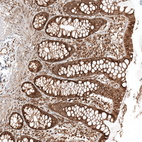 Immunohistochemical staining of human colon shows moderate membranous and cytoplasmic positivity in glandular cells.