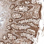 Immunohistochemical staining of human colon shows moderate membranous and cytoplasmic positivity in glandular cells.