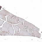 Immunohistochemical staining of human skeletal muscle shows very weak cytoplasmic positivity in myocytes.