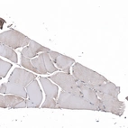 Immunohistochemical staining of human skeletal muscle shows very weak cytoplasmic positivity in myocytes.