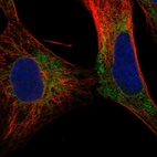 Anti-SLC17A8 Antibody