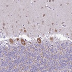 Anti-PELI3 Antibody