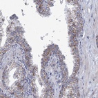 Anti-NDUFC2 Antibody
