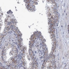 Anti-NDUFC2 Antibody
