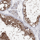 Anti-GTSF1 Antibody