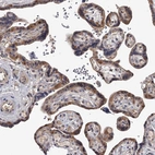 Immunohistochemical staining of human placenta shows moderate cytoplasmic positivity in trophoblastic cells.