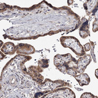 Immunohistochemical staining of human Placenta shows moderate cytoplasmic positivity in trophoblastic cells.