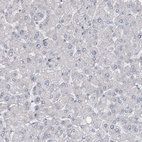 Immunohistochemical staining of human Liver shows no positivity in hepatocytes as expected.