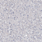 Anti-GTSF1 Antibody