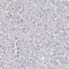 Immunohistochemical staining of human Liver shows no positivity in hepatocytes as expected.