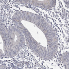 Immunohistochemical staining of human Endometrium shows no positivity in glandular cells as expected.