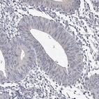 Immunohistochemical staining of human Endometrium shows no positivity in glandular cells as expected.