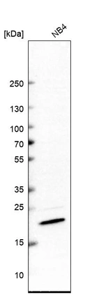 Western blot analysis in human cell line NB4.