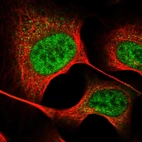 Immunofluorescent staining of human cell line U-2 OS shows localization to nucleoplasm.