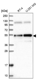 Western blot analysis in human cell line RT-4 and human cell line U-251 MG.