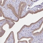 Immunohistochemical staining of human fallopian tube shows moderate cytoplasmic positivity in glandular cells.