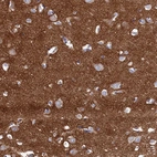 Anti-C12orf73 Antibody