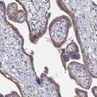 Immunohistochemical staining of human placenta shows moderate cytoplasmic positivity in trophoblastic cells.