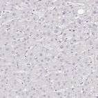Immunohistochemical staining of human liver shows no positivity in hepatocytes as expected.