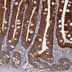 Immunohistochemical staining of human gastrointestinal shows moderate to strong cytoplasmic positivity in glandular cells.