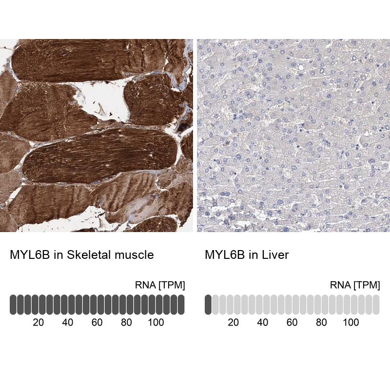 Anti-MYL6B Antibody