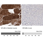 Anti-MYL6B Antibody