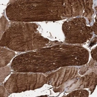 Immunohistochemical staining of human skeletal muscle shows strong cytoplasmic positivity in myocytes.
