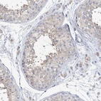 Immunohistochemical staining of human testis shows weak cytoplasmic positivity in cells in seminiferous ducts.