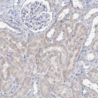Immunohistochemical staining of human kidney shows moderate cytoplasmic positivity in cells in tubules.