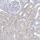 Immunohistochemical staining of human kidney shows moderate cytoplasmic positivity in cells in tubules.