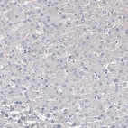 Immunohistochemical staining of human liver shows no positivity in hepatocytes as expected.
