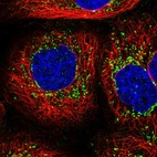 Immunofluorescent staining of human cell line A-431 shows localization to vesicles.