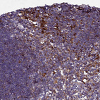 Immunohistochemical staining of human lymph node shows positivity in lymphoid cells.