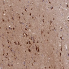 Immunohistochemical staining of human cerebral cortex shows positivity in neurons.