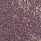Immunohistochemical staining of human lymph node shows high expression.