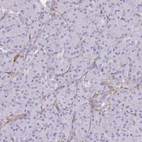 Immunohistochemical staining of human pancreas shows low expression as expected.