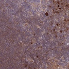 Anti-CDC25B Antibody