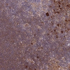 Immunohistochemical staining of human lymph node shows high expression.
