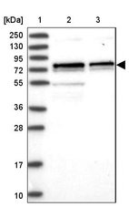 Lane 1: Marker [kDa] 250, 130, 95, 72, 55, 36, 28, 17, 10_br/_Lane 2: Human cell line RT-4_br/_Lane 3: Human cell line U-251MG sp