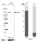 Western blot analysis in human cell line CACO-2 and human cell line PC-3.