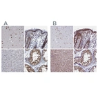 Anti-PPHLN1 Antibody