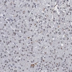 Immunohistochemical staining of human liver shows weak nuclear positivity in hepatocytes.