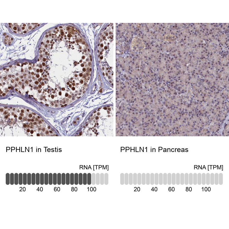 Anti-PPHLN1 Antibody