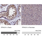 Anti-PPHLN1 Antibody