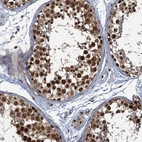 Immunohistochemical staining of human testis shows moderate to strong nuclear positivity in cells in seminiferous ducts.