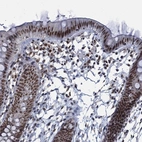 Immunohistochemical staining of human colon shows moderate to strong nuclear positivity in glandular cells.