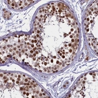Immunohistochemical staining of human testis shows moderate to strong nuclear positivity in cells in seminiferous ducts.