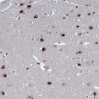 Immunohistochemical staining of human cerebral cortex shows moderate to strong nuclear positivity in neurons.